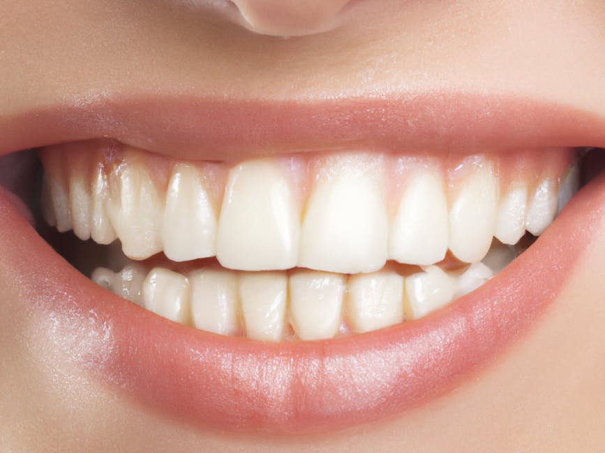 What's the Difference Between Teeth Whitening Methods? 1 teeth whitening
