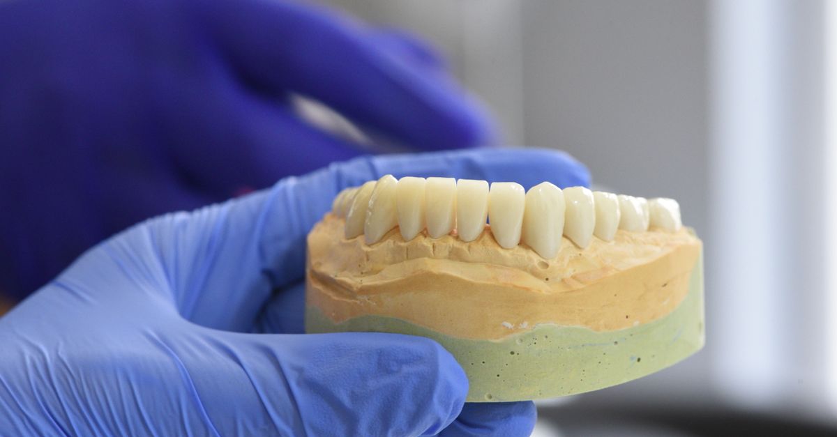 Cureus Review Examines Soft Tissue Care in Peri-Implantitis Treatment