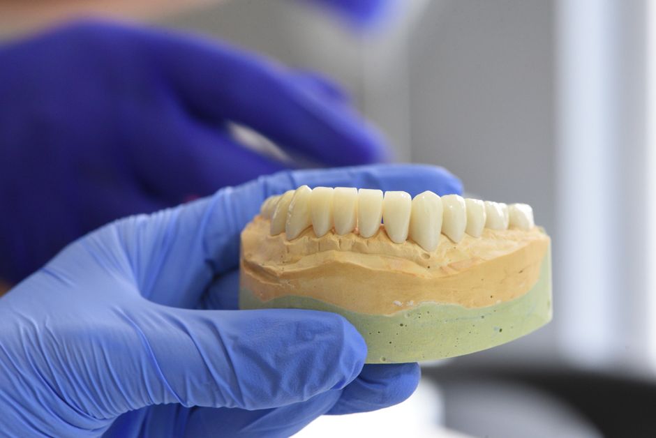 Modèle dentaire numérique tenu par un professionnel en laboratoire