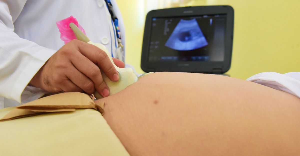 Exploring the Complex Link Between Fertility Treatments and Migraine