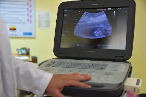 Ultrasound Scan on Screen