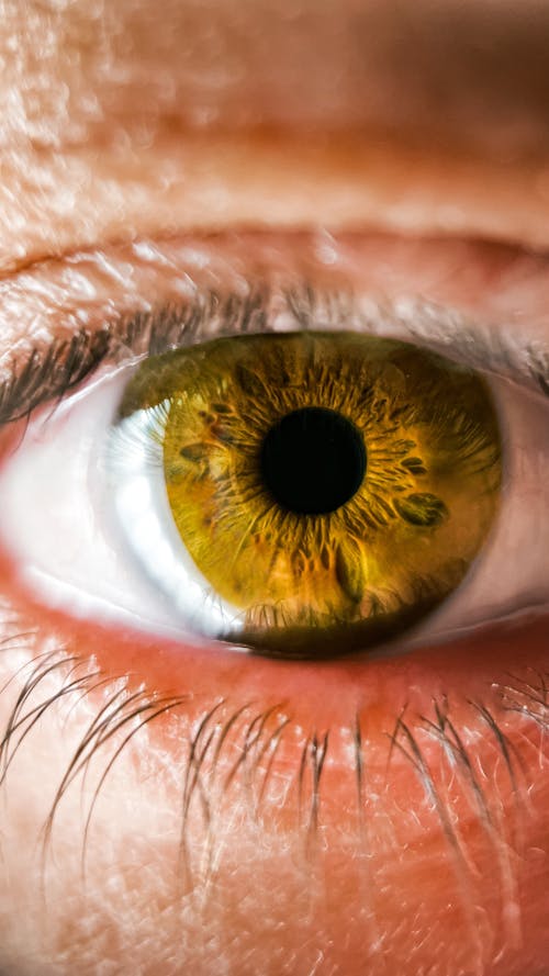 A close up of a person's eye with yellow iris