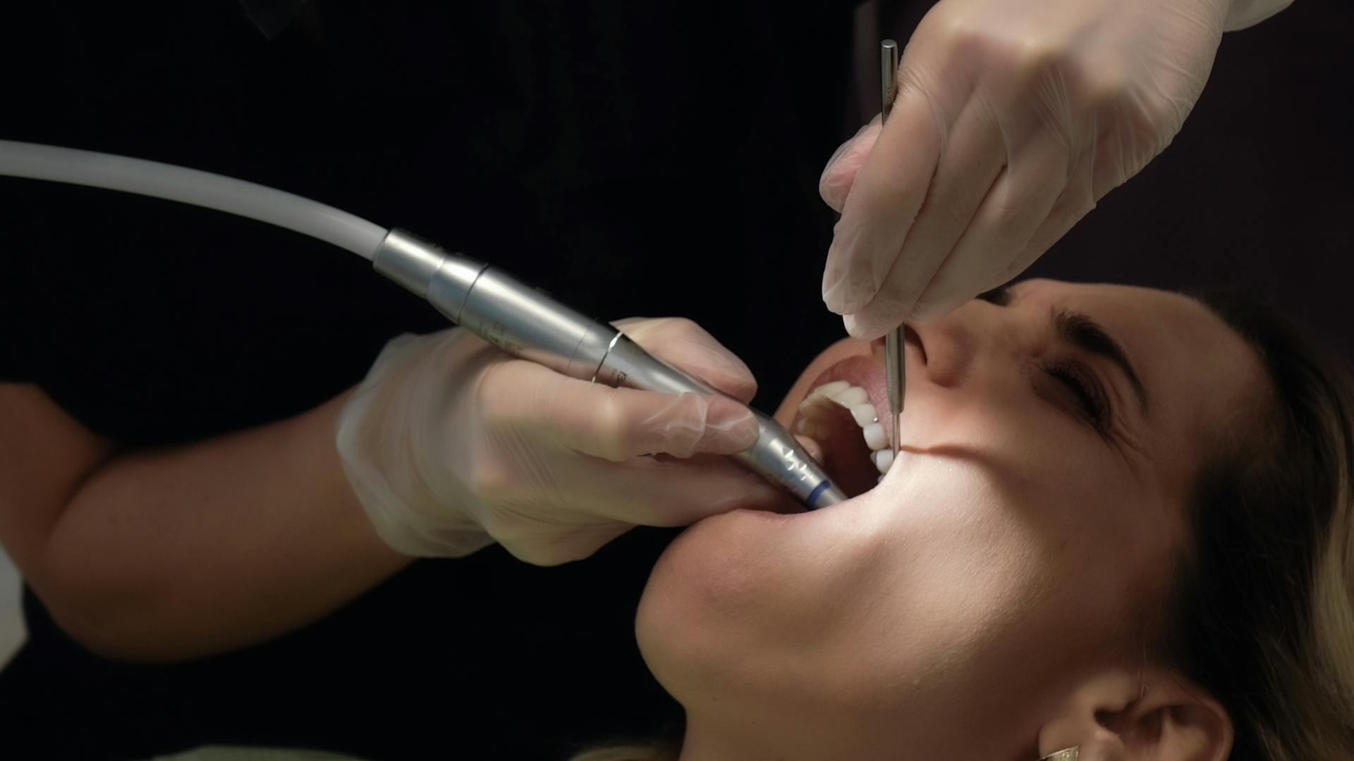 Close up of Dentist Hands over Patient Mouth