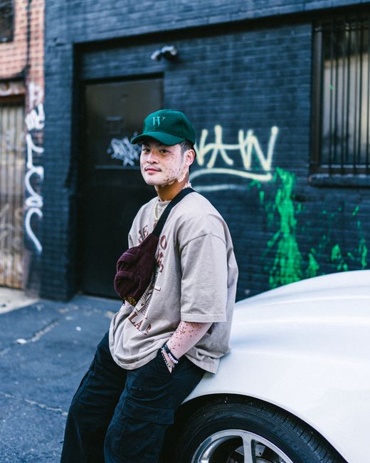 Man with vitiligo leans on a car against graffiti wall, showcasing urban street fashion.