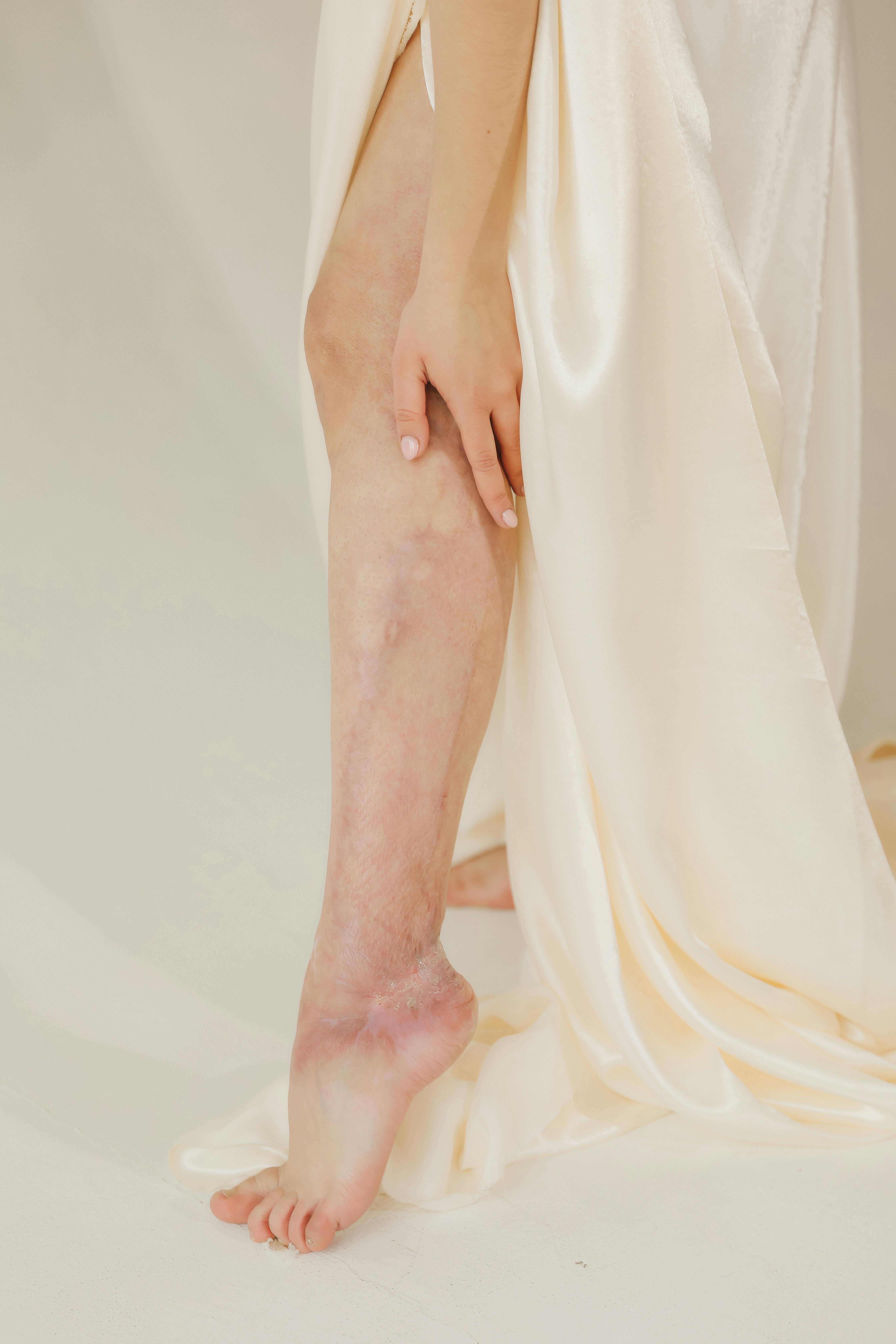 Woman Hand Touching Leg in White Dress