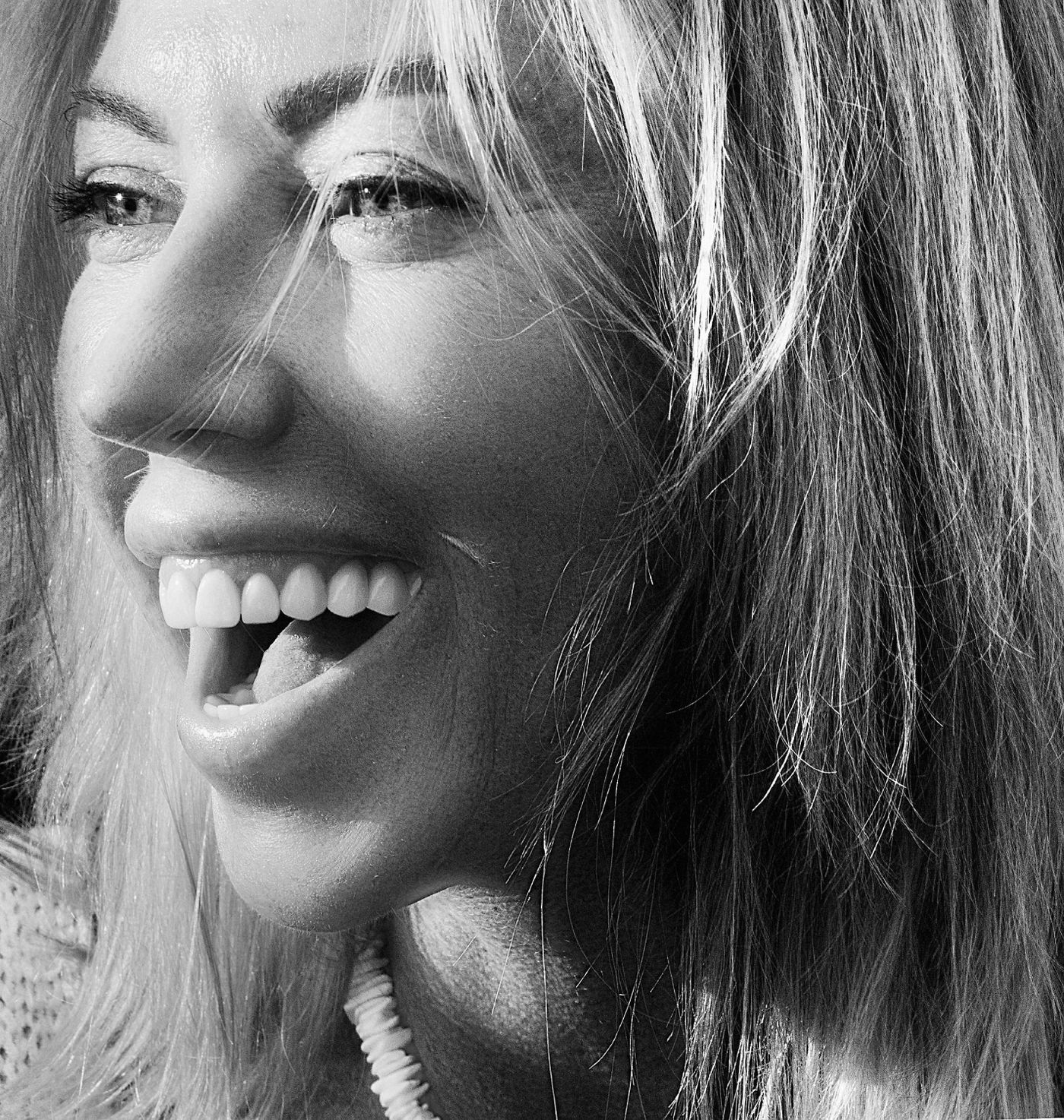 Woman laughing with a wide, confident smile, gummy smile Botox in Houston