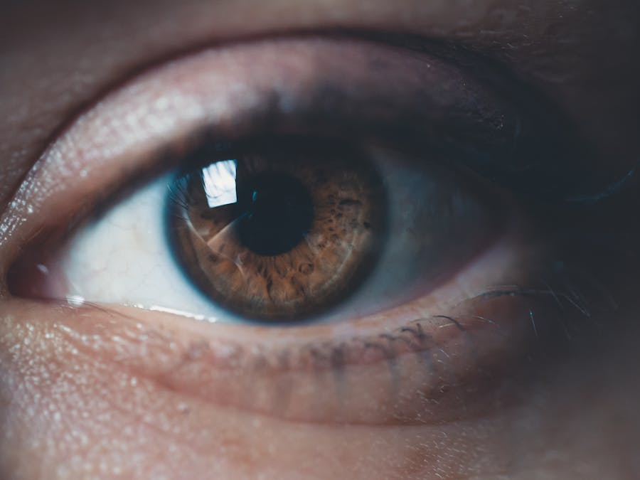 What is the rarest eye color?