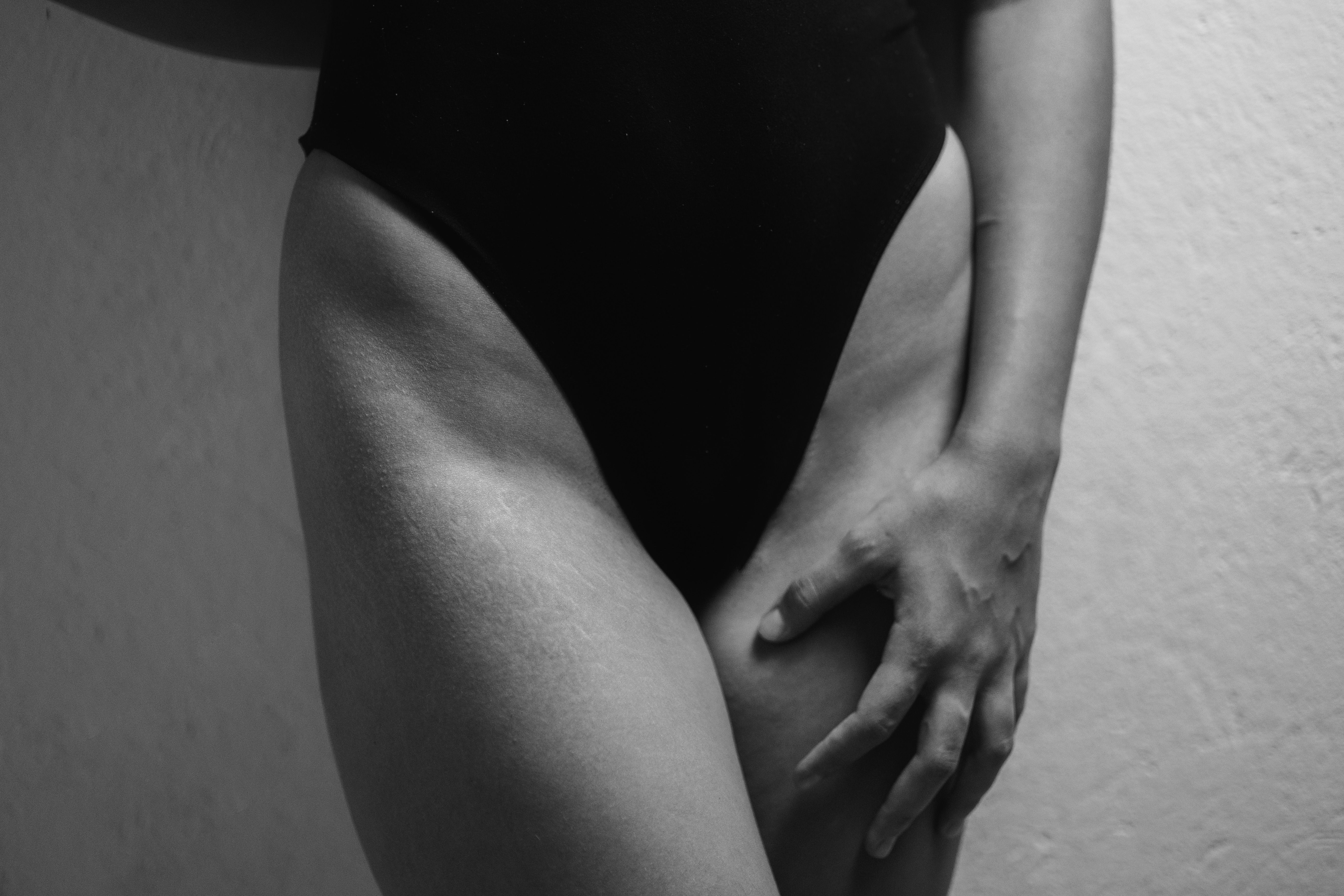 Diuriefit Black auxiliando no combate ao edema e retenção hídrica