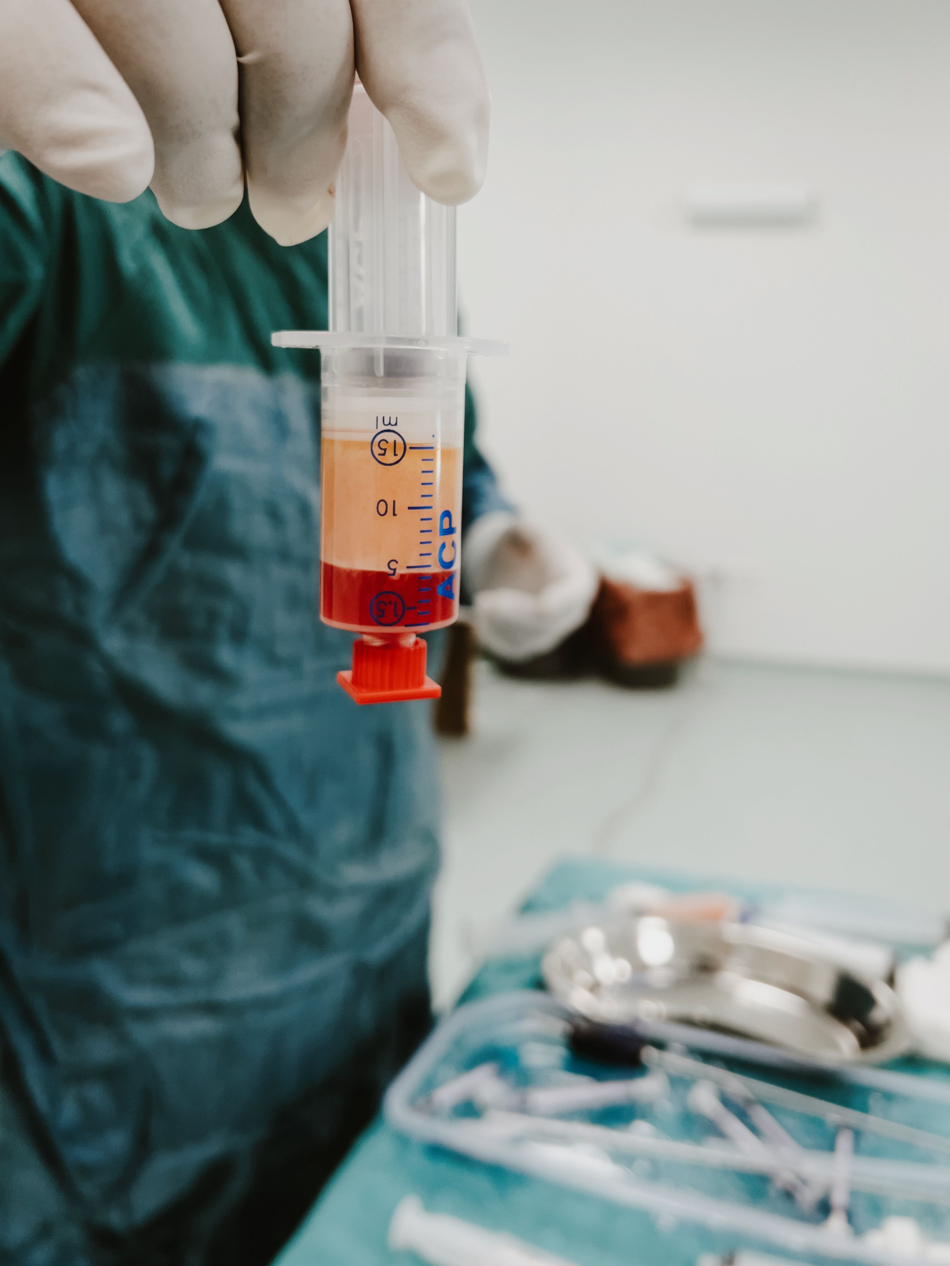 Autologous Stem Cell Therapy: Is Fresh or Frozen Better for Recovery?