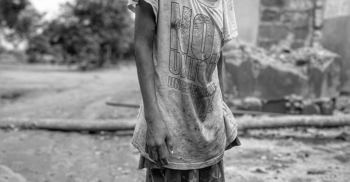 Black and White Portrait of a Thin Boy in Ragged Clothes Standing by a ...
