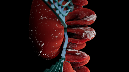 COPD: Early aggressive therapy isn't just for lungs