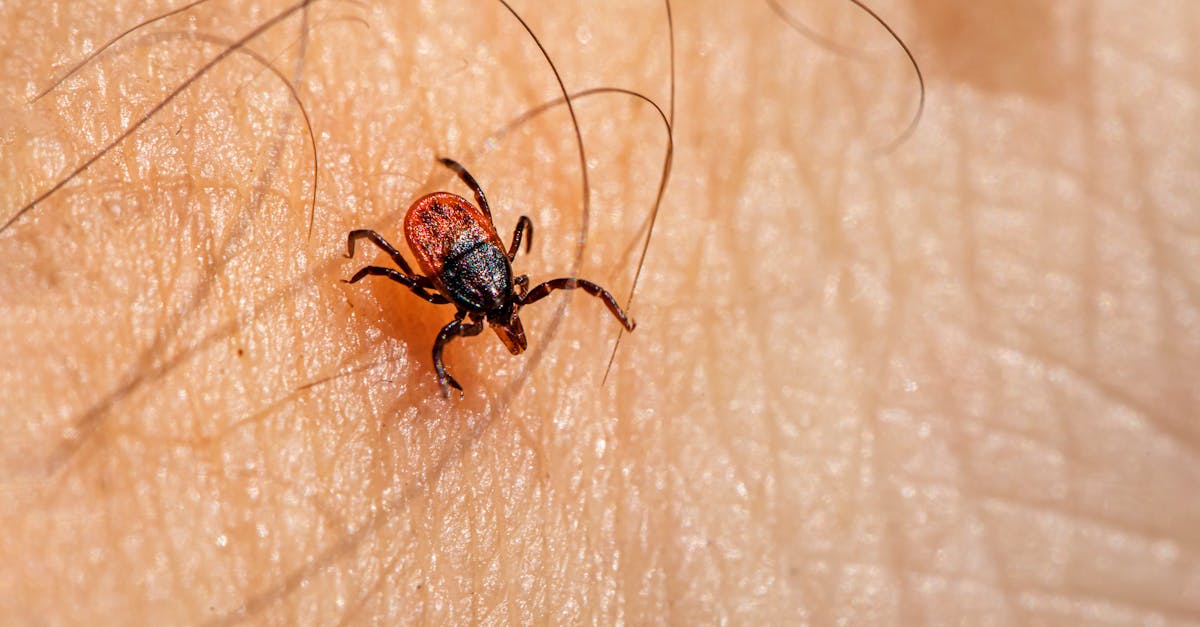 A tick is on the skin of a person