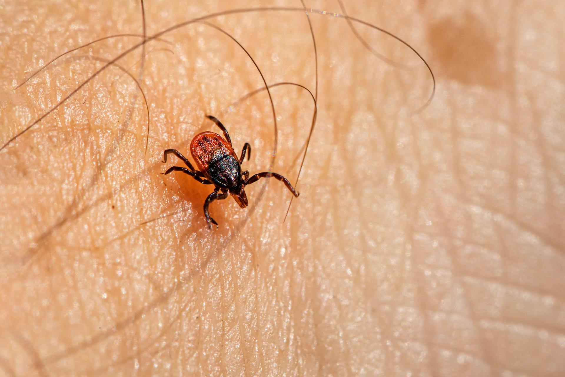 A tick is on the skin of a person