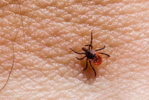 Detailed macro image of a castor bean tick (Ixodes ricinus) on human skin.