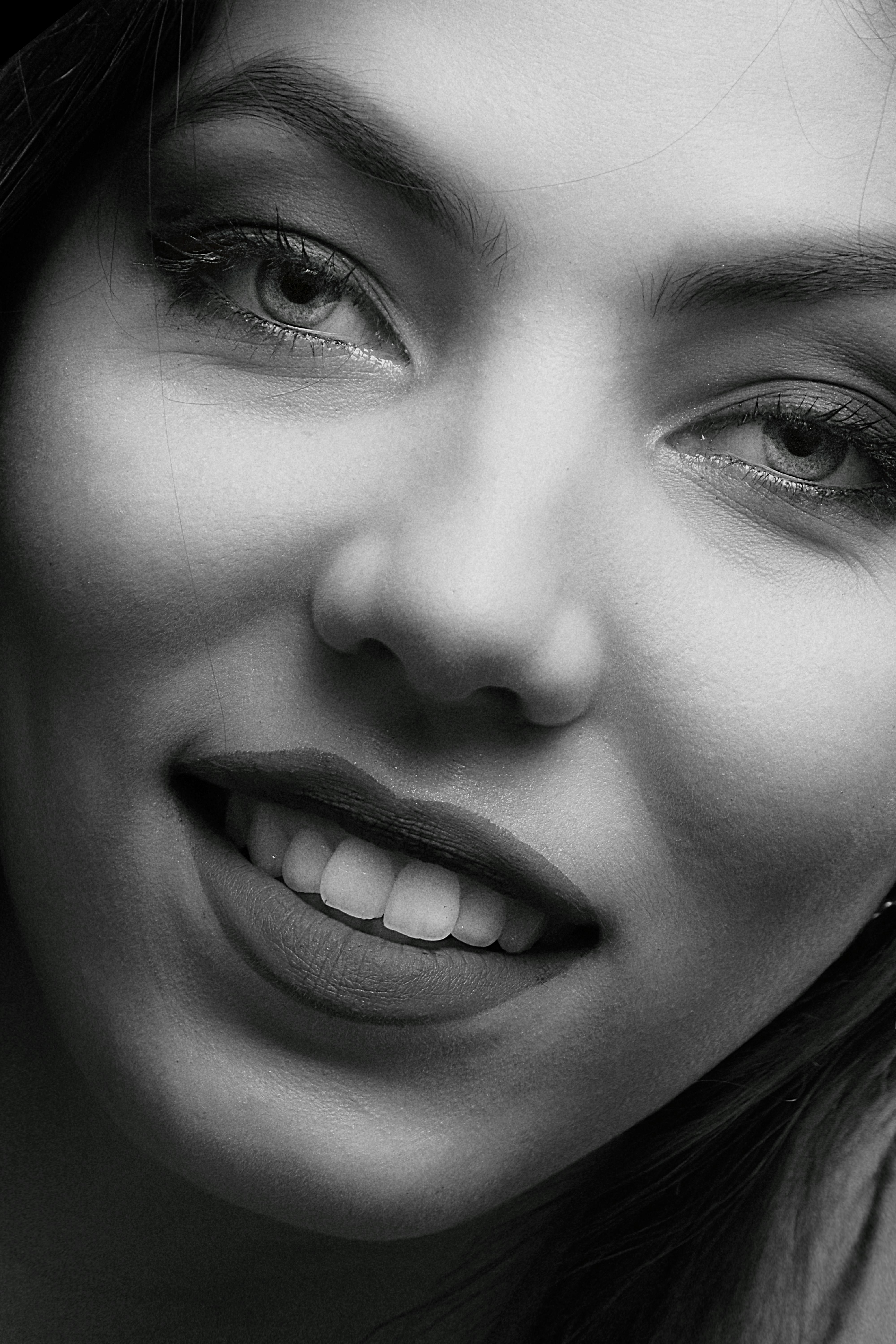 Orthodontic result