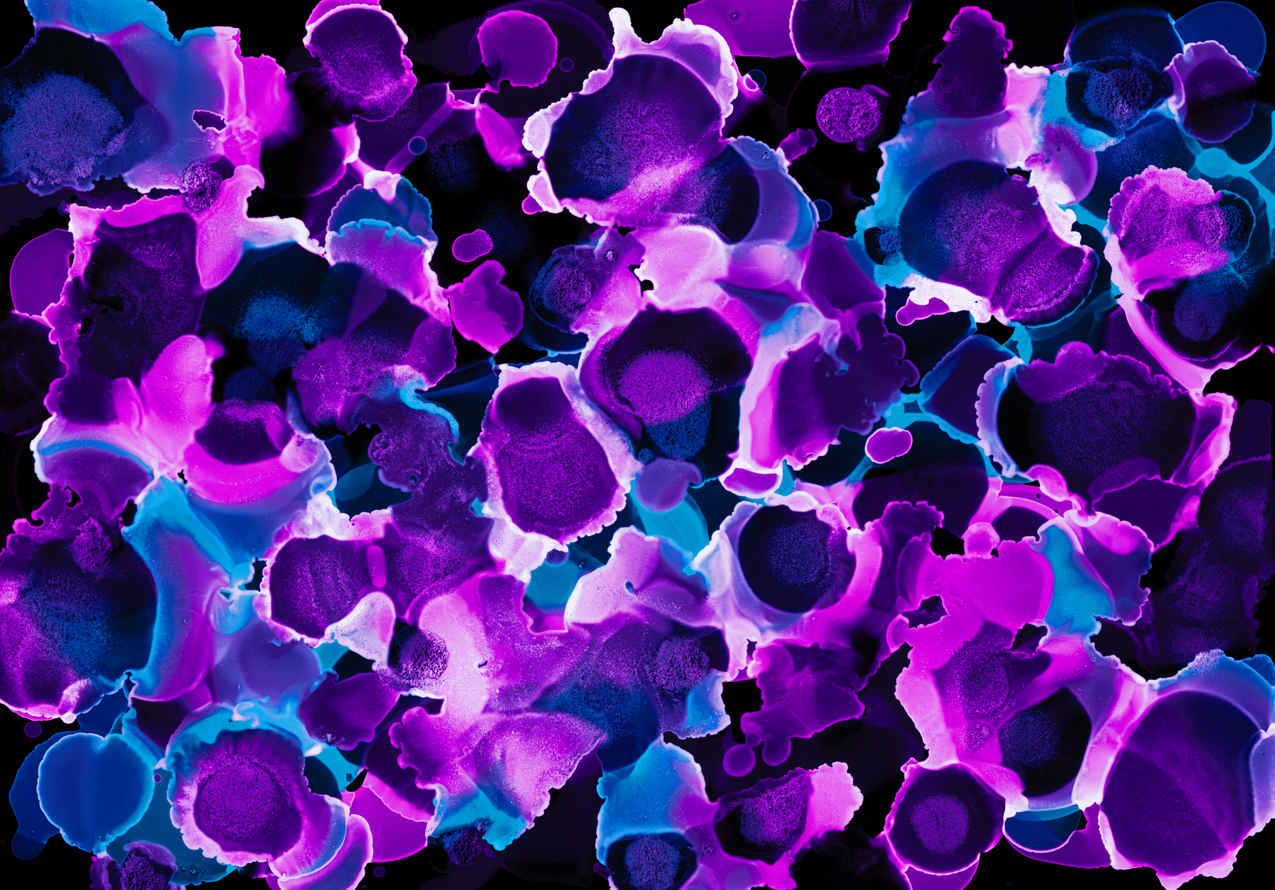 Addison's Disease vs. Cushing Syndrome: Understanding the Differences