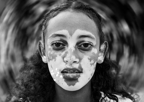 Striking black and white close-up portrait capturing a woman with vitiligo.