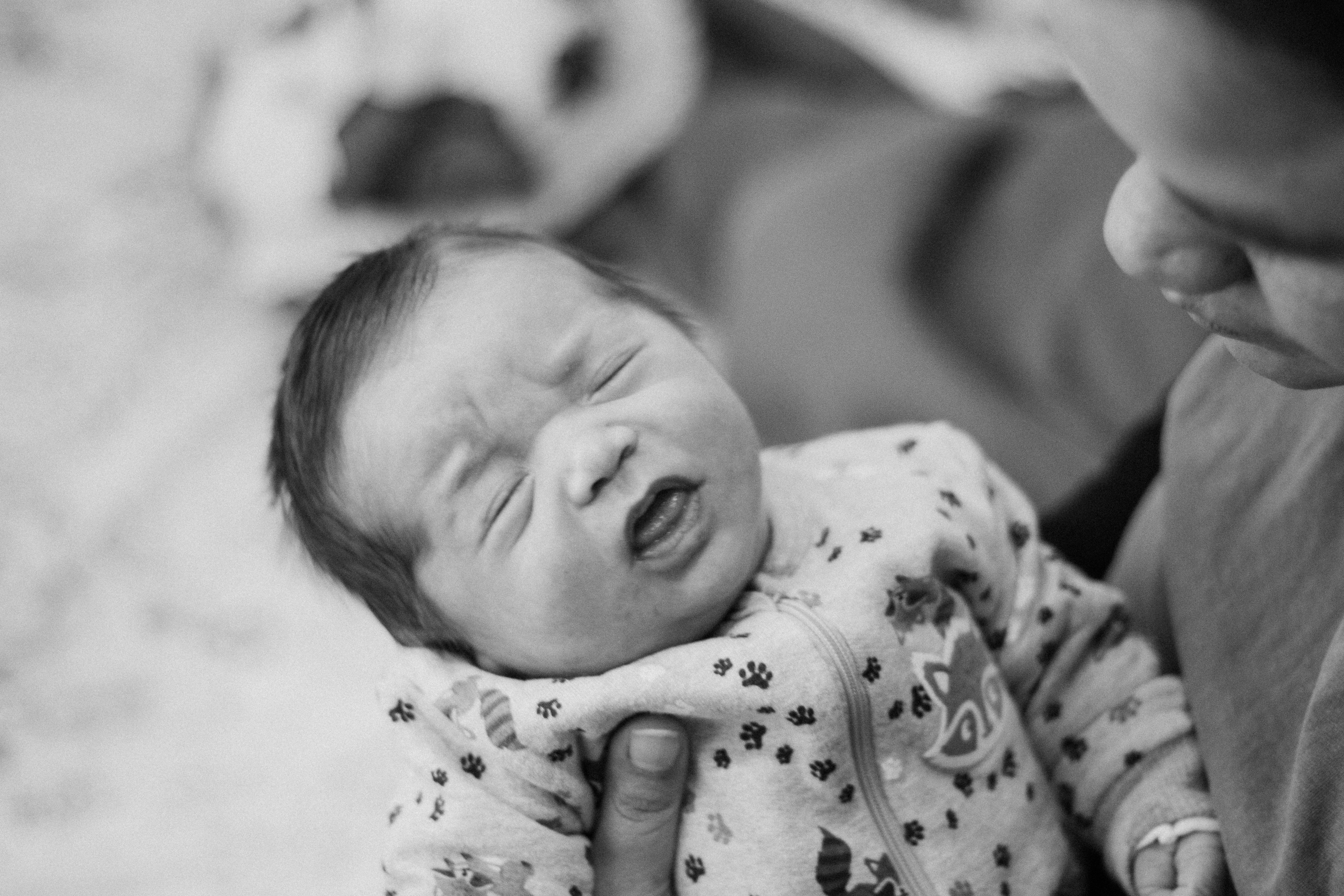 Understanding Hemolytic Anemia in Newborns: Causes, Symptoms, and Treatment