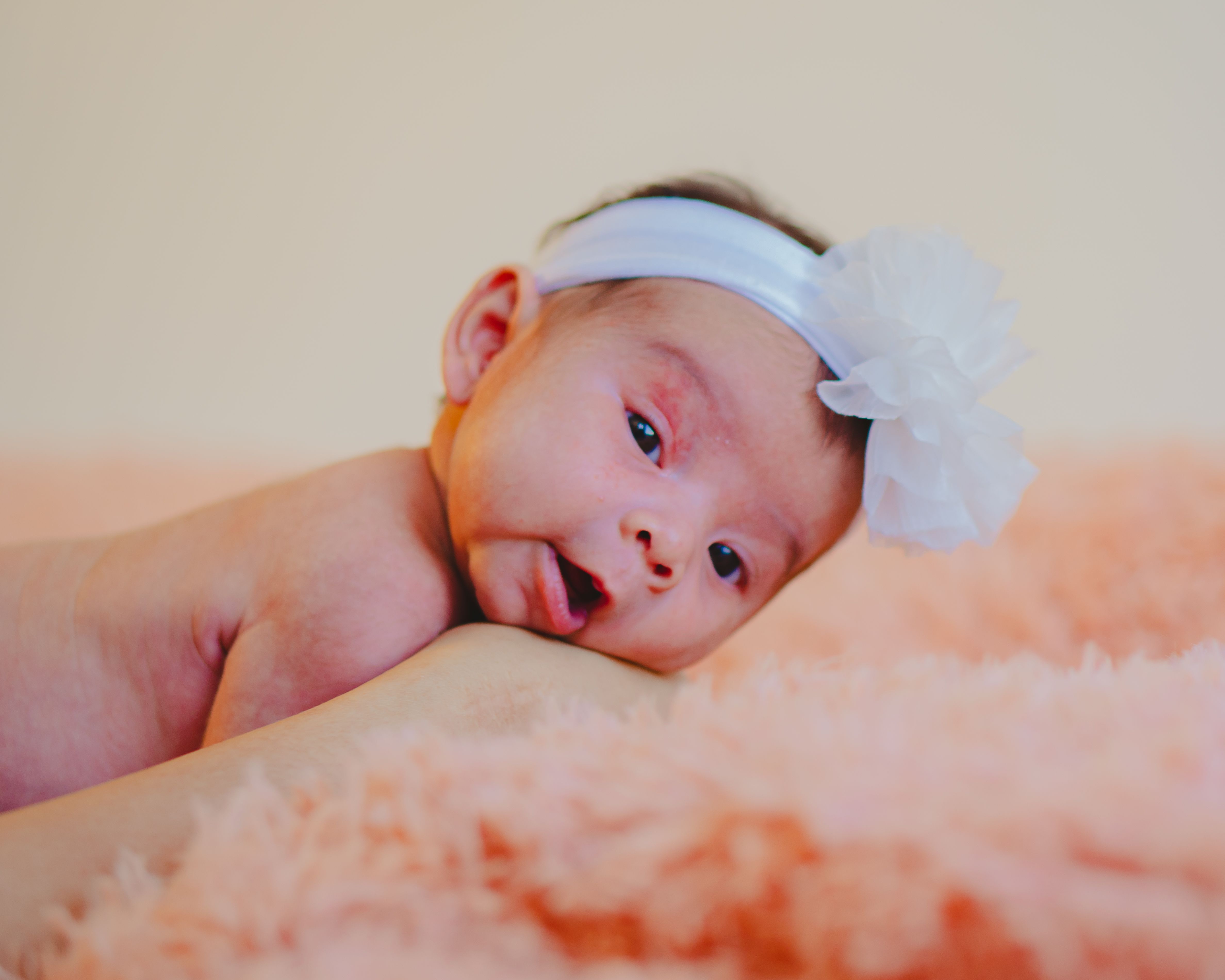 Holoprosencephaly (HPE): Penyebab, Gejala, Diagnosis, dan Tatalaksana