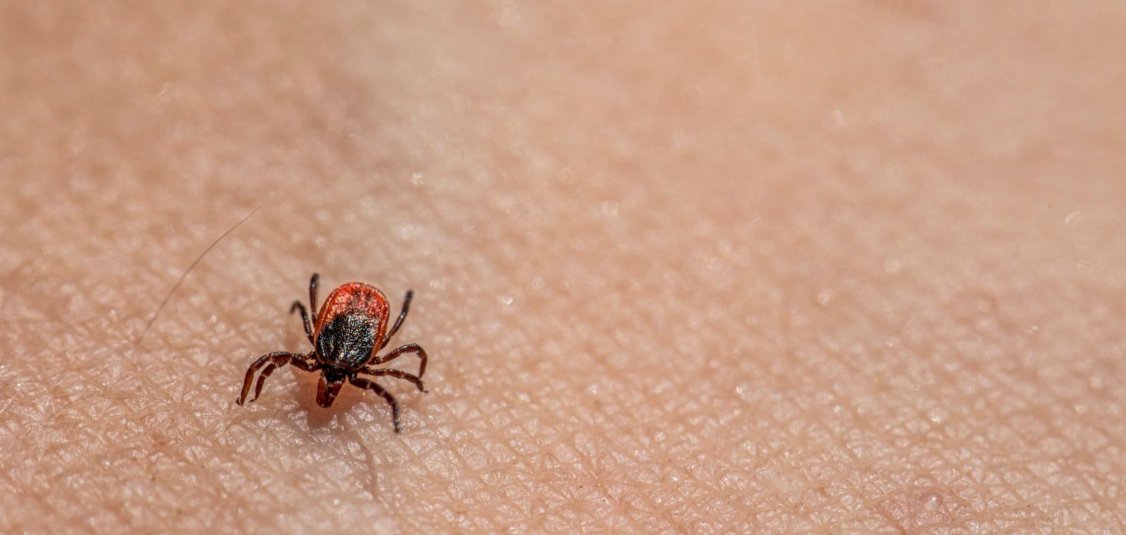 Tick on skin, close-up