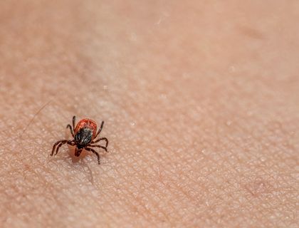 Tick on skin, close-up