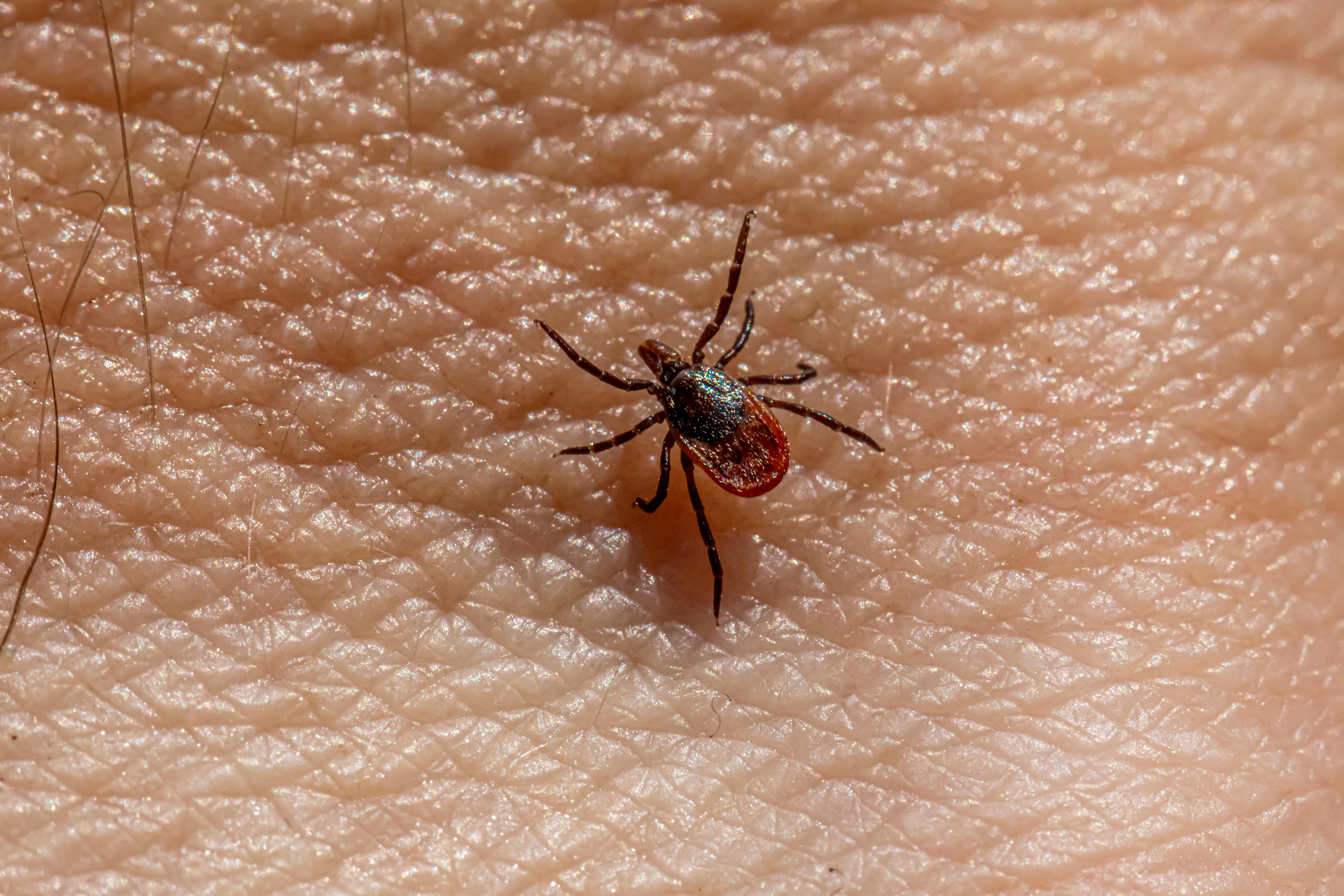 A tick is on the skin of a person