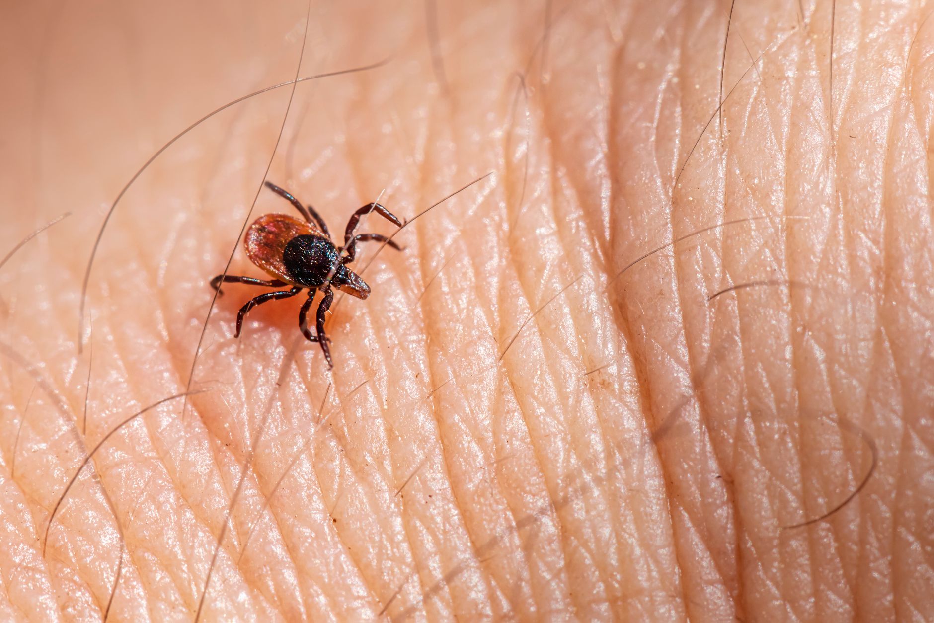 Is That Bug Bite Infected? Signs, Symptoms, and When to See a Doctor