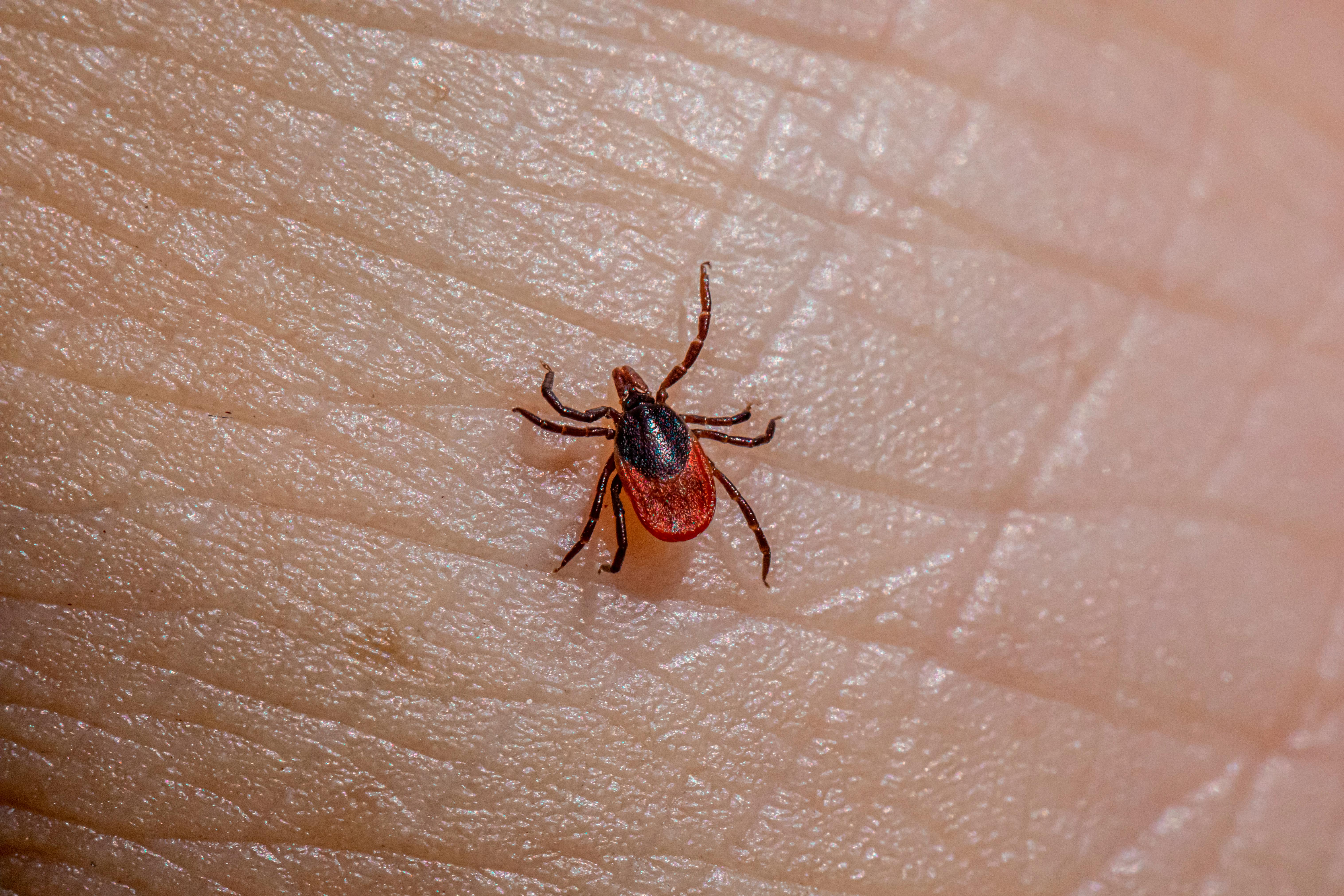 a tick on a person s hand