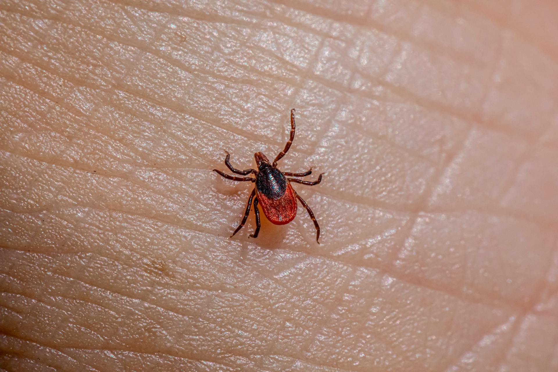 A tick on a person's hand