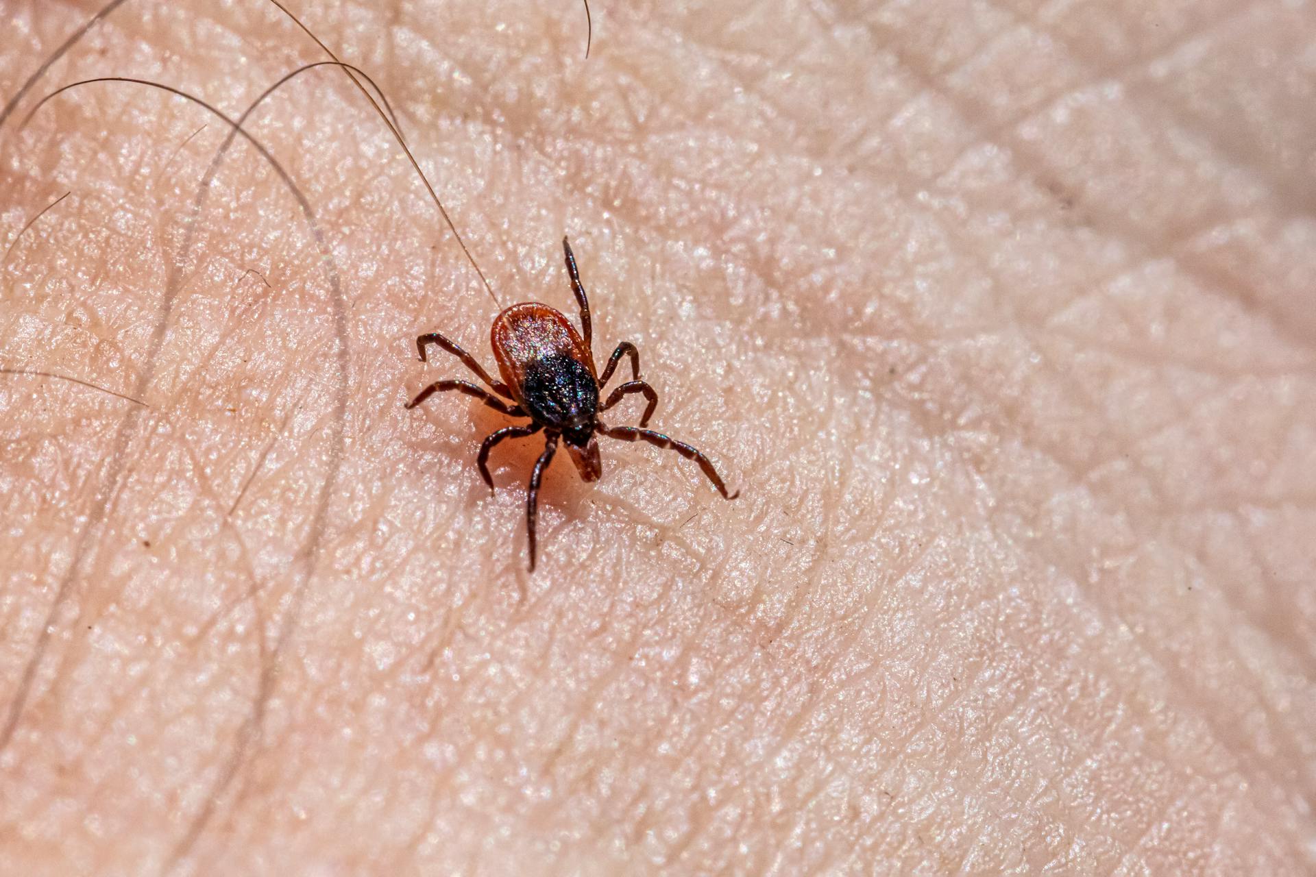 A tick on a person's skin