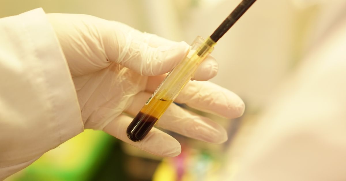 Sample Hand Hand of a Scientist Handling a Blood Sample · Free Stock Photo
