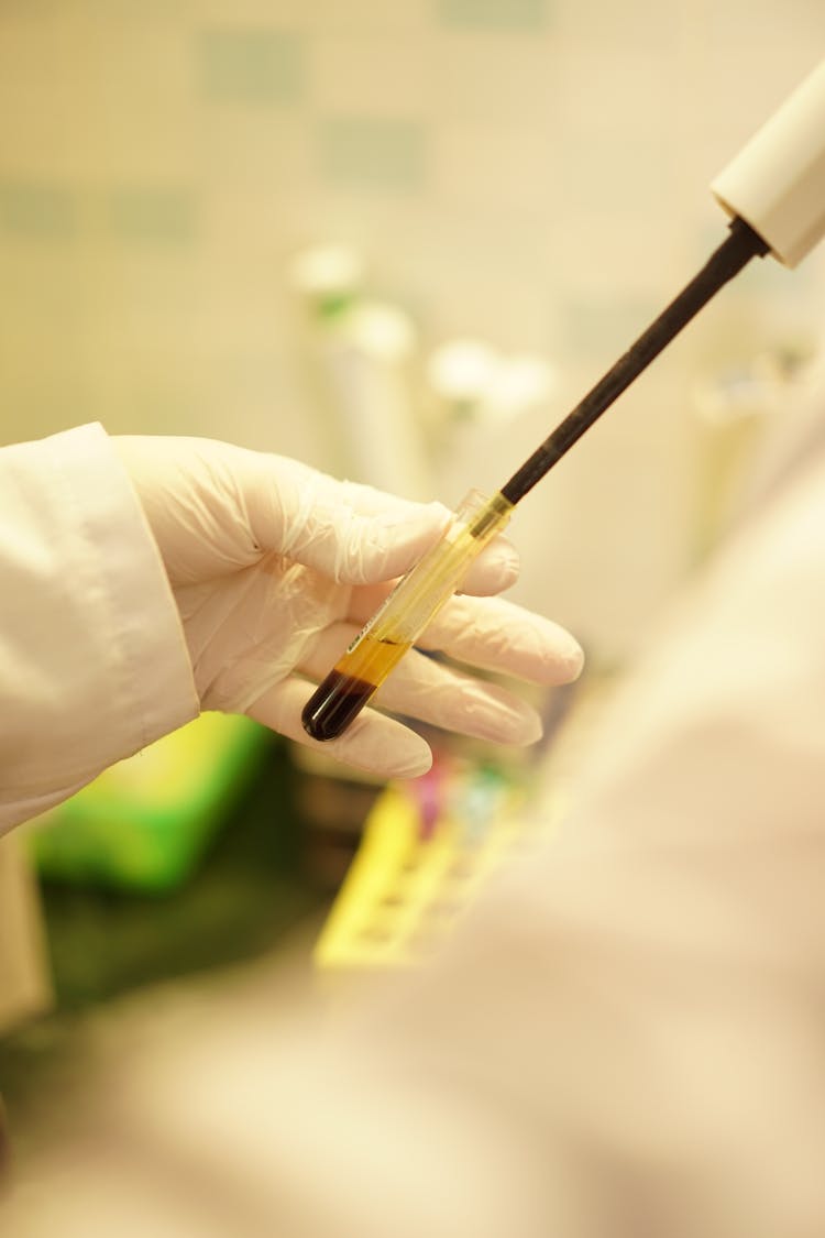 Hand Of A Scientist Handling A Blood Sample