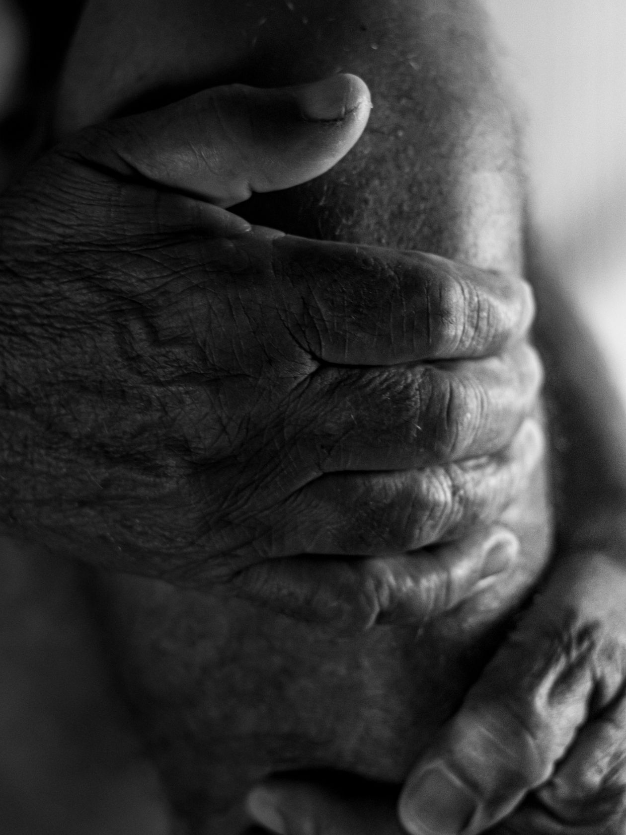 Elderly man's hands gripping his leg below the knee