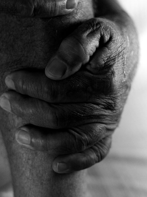 Free Emotive black and white close-up of elderly hands embracing a knee. Stock Photo