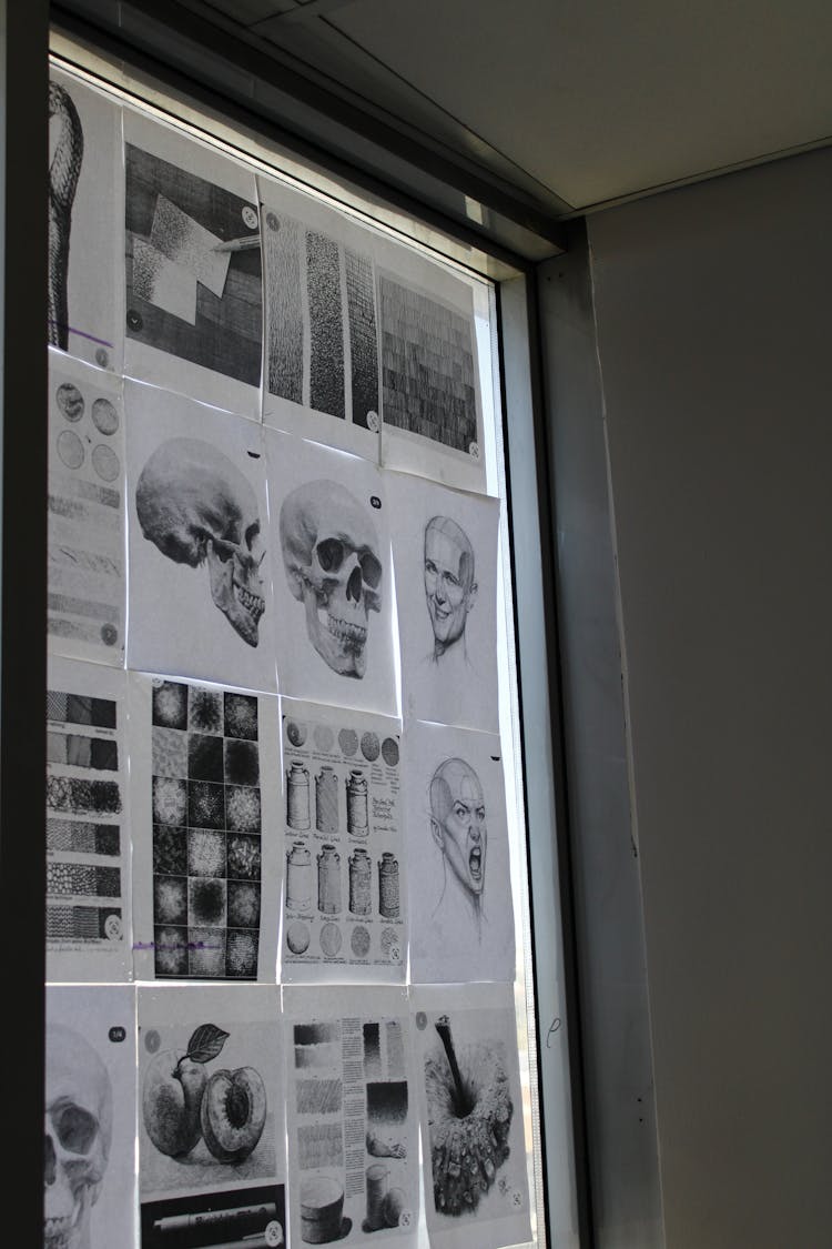 X-Ray Photos On A Board In Black And White