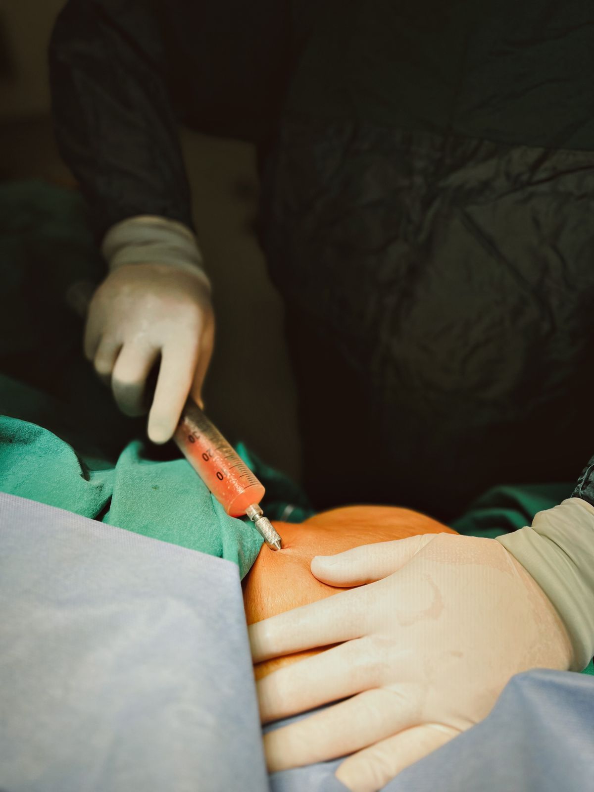 Doctor performing liposuction in a New York clinic