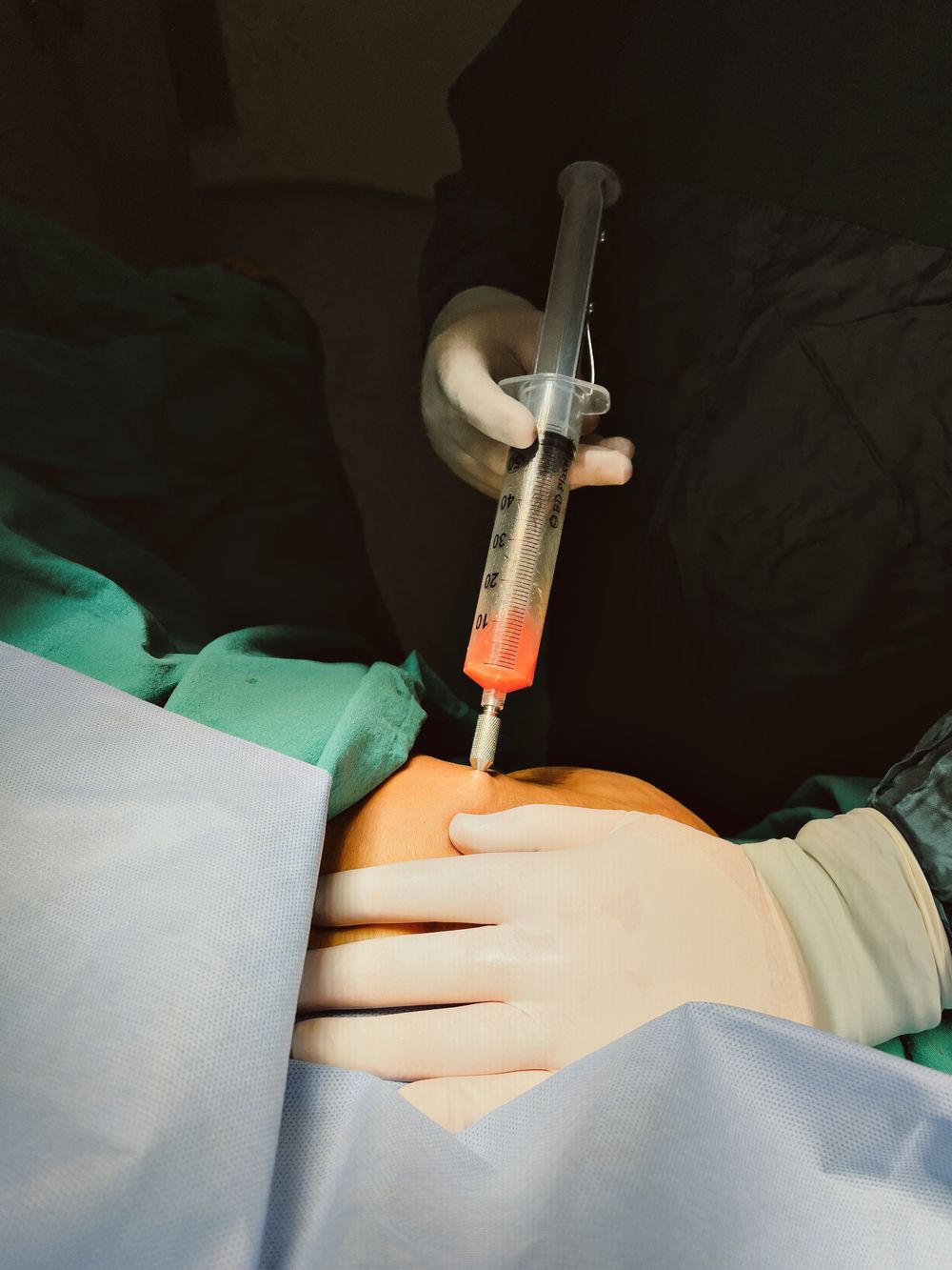 Nano Fat Transfer