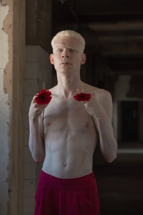 Albino Man Posing Shirtless and Holding Red Flowers