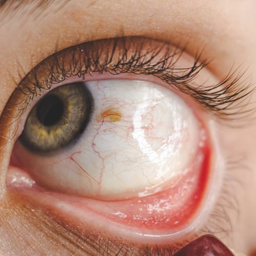 Free Close-up of an Eye of a Woman Looking to the Side  Stock Photo