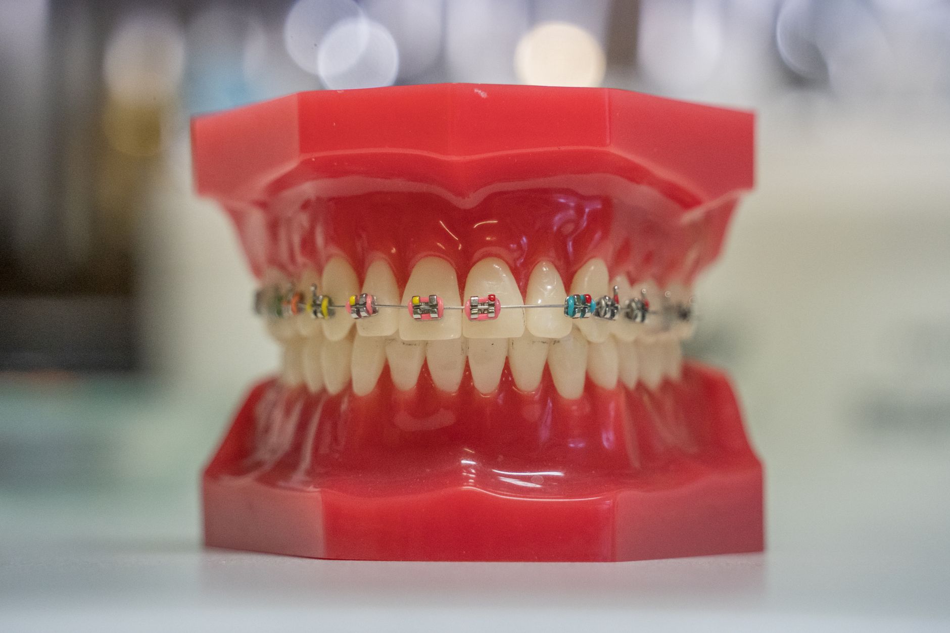 The Art Of Orthodontics Achieving Lasting Smiles With Braces
