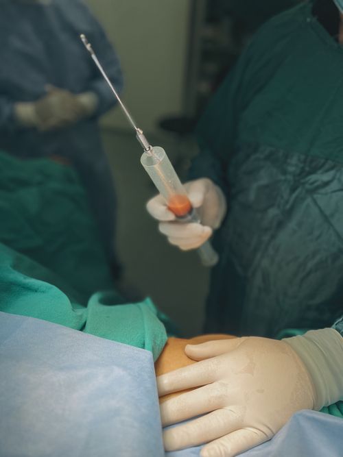 Free Close-up of a doctor with syringe administering an injection in a clinical setting. Stock Photo