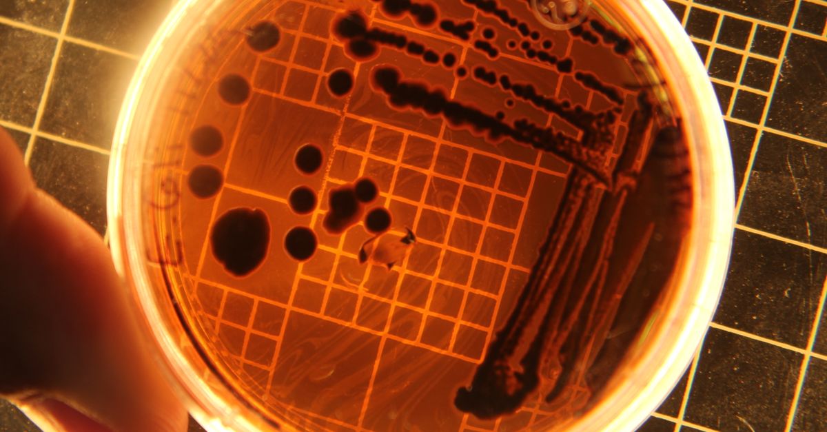 Close-up of bacteria colonies in a petri dish under laboratory conditions. - Evidence evidence guide for red yeast rice cholesterol meta-analysis