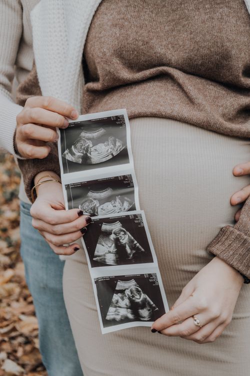 Free Pregnant couple holding ultrasound images, showing family anticipation. Stock Photo