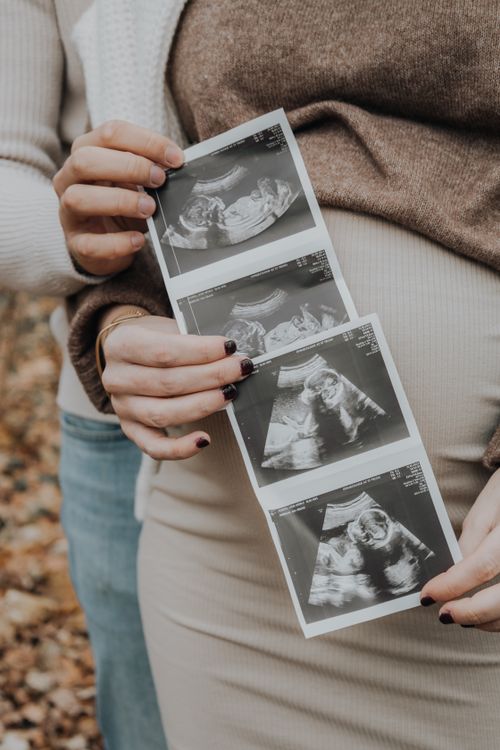 Free Couple holding ultrasound photos indicating pregnancy, showcasing prenatal excitement. Stock Photo