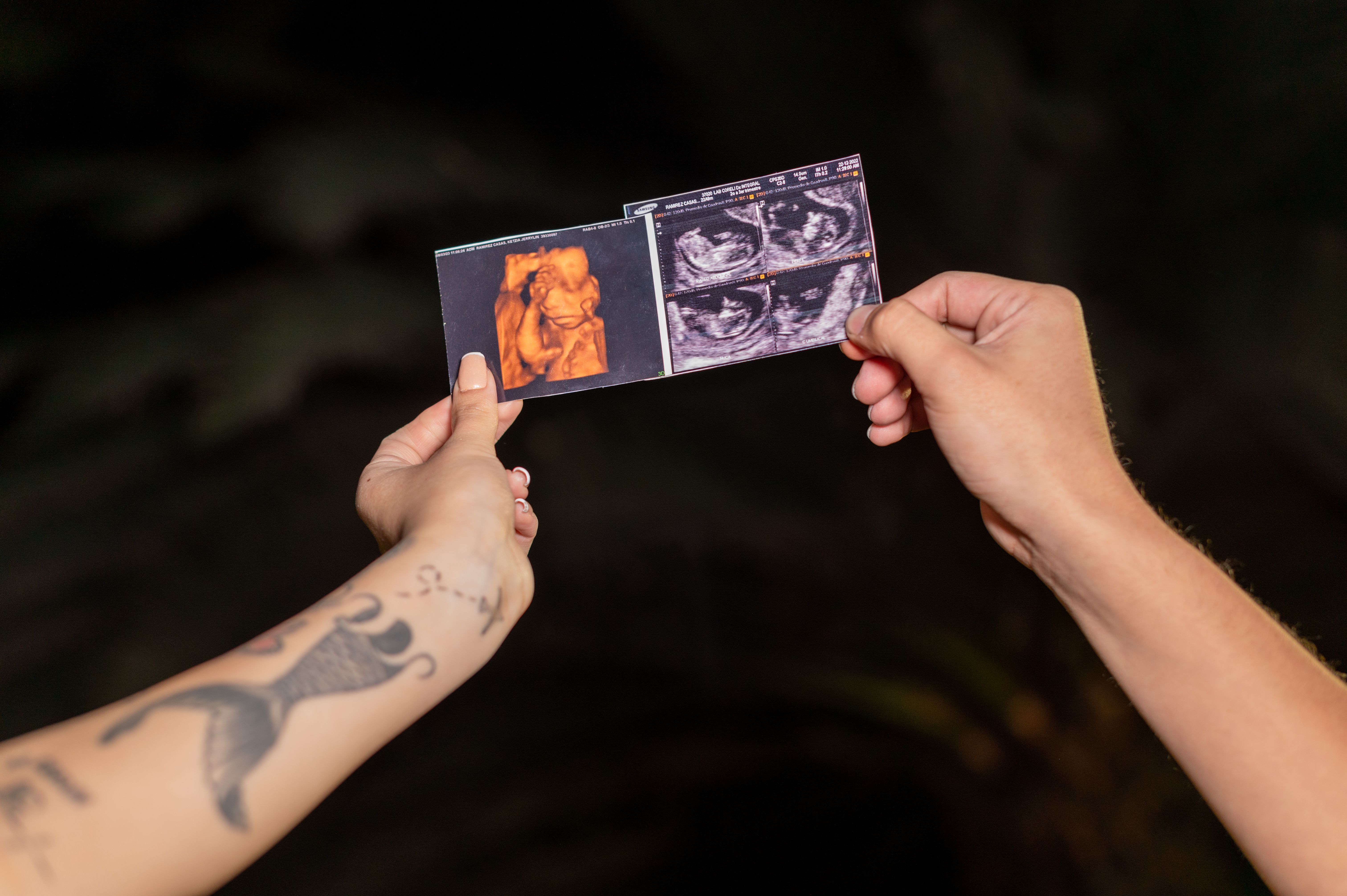Macon Georgia community — a first-mover market for keepsake ultrasound studio owners