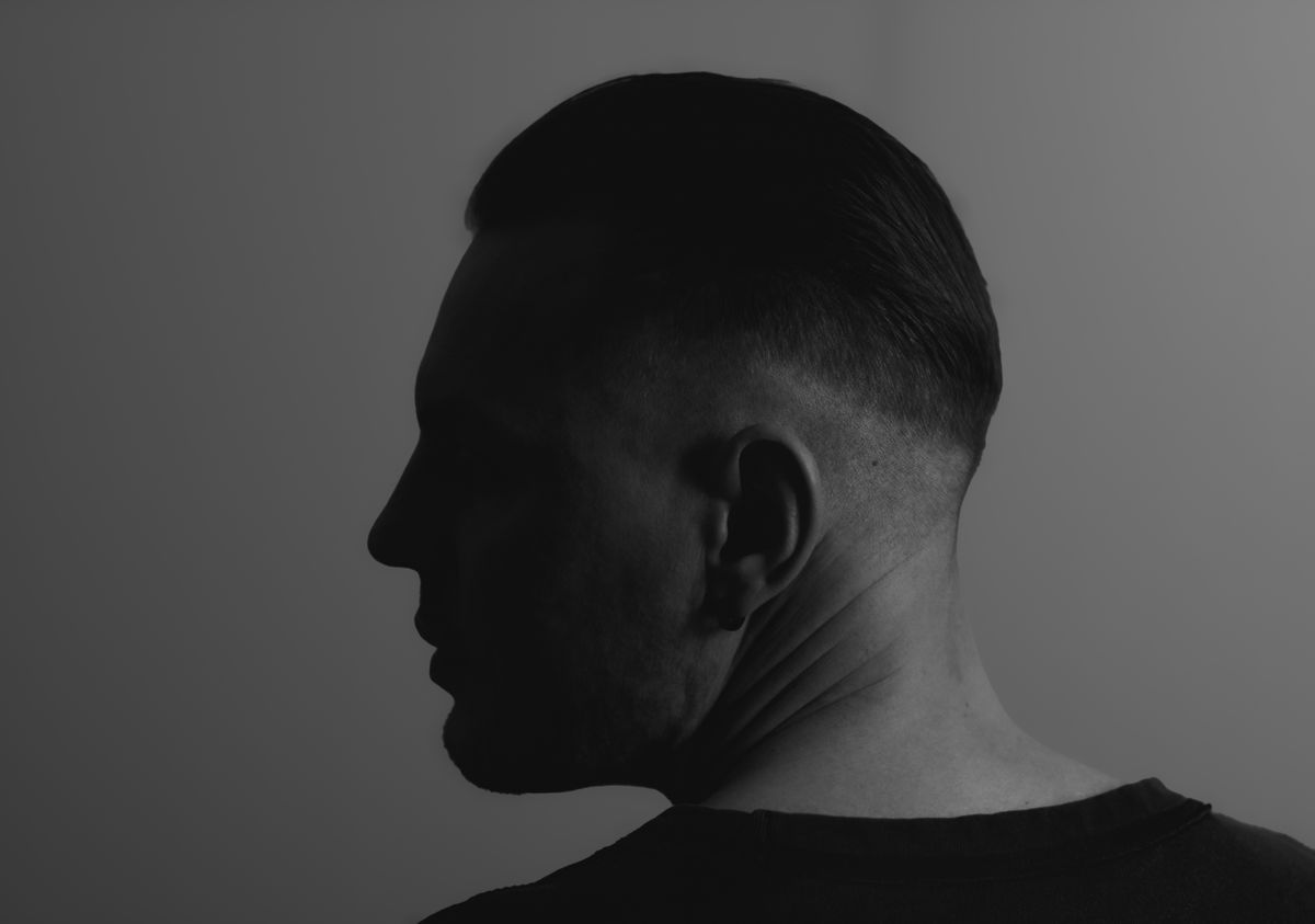 Rear and side view of a man's short haircut showing the usual scalp donor region