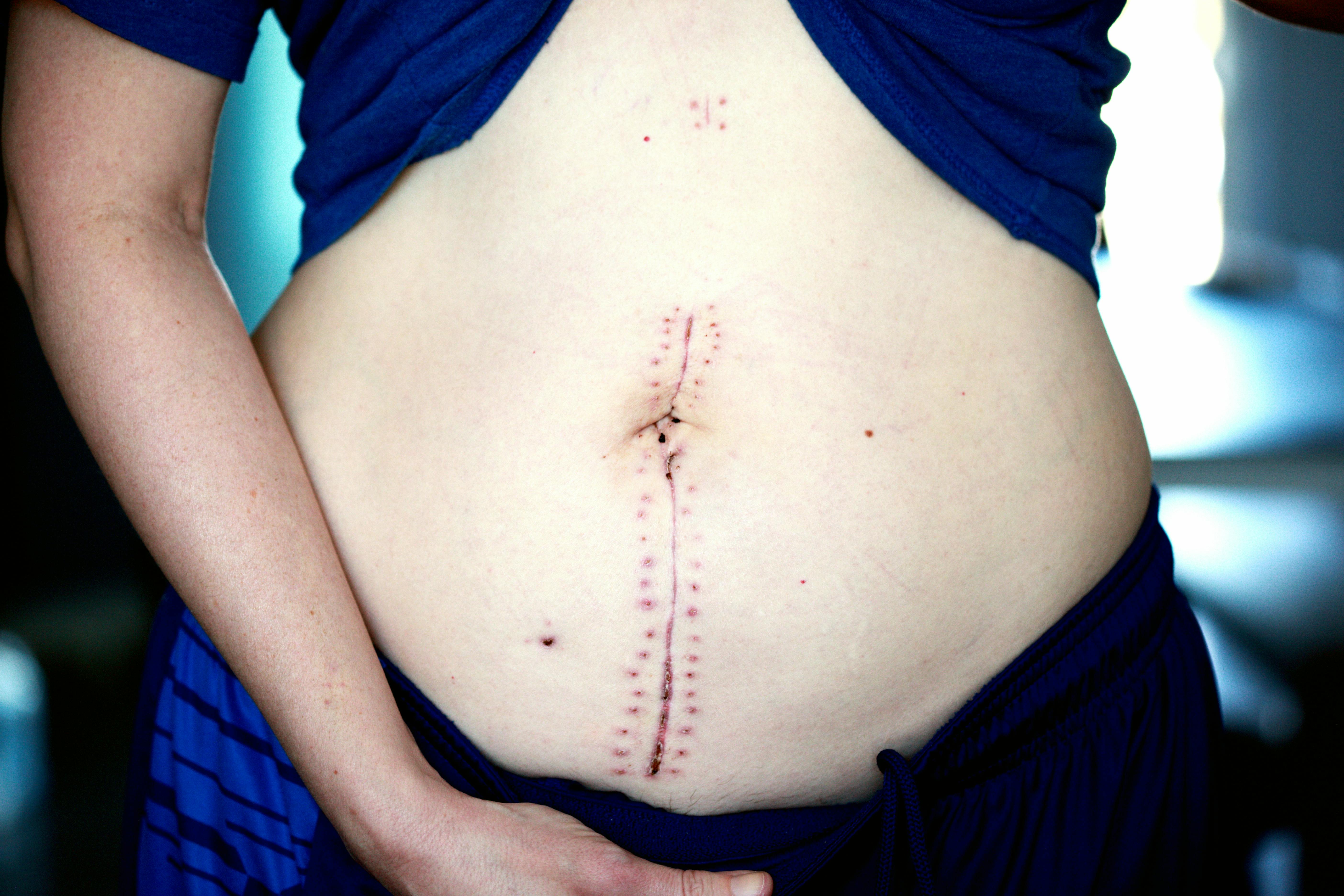 woman showing her belly while wearing blue top