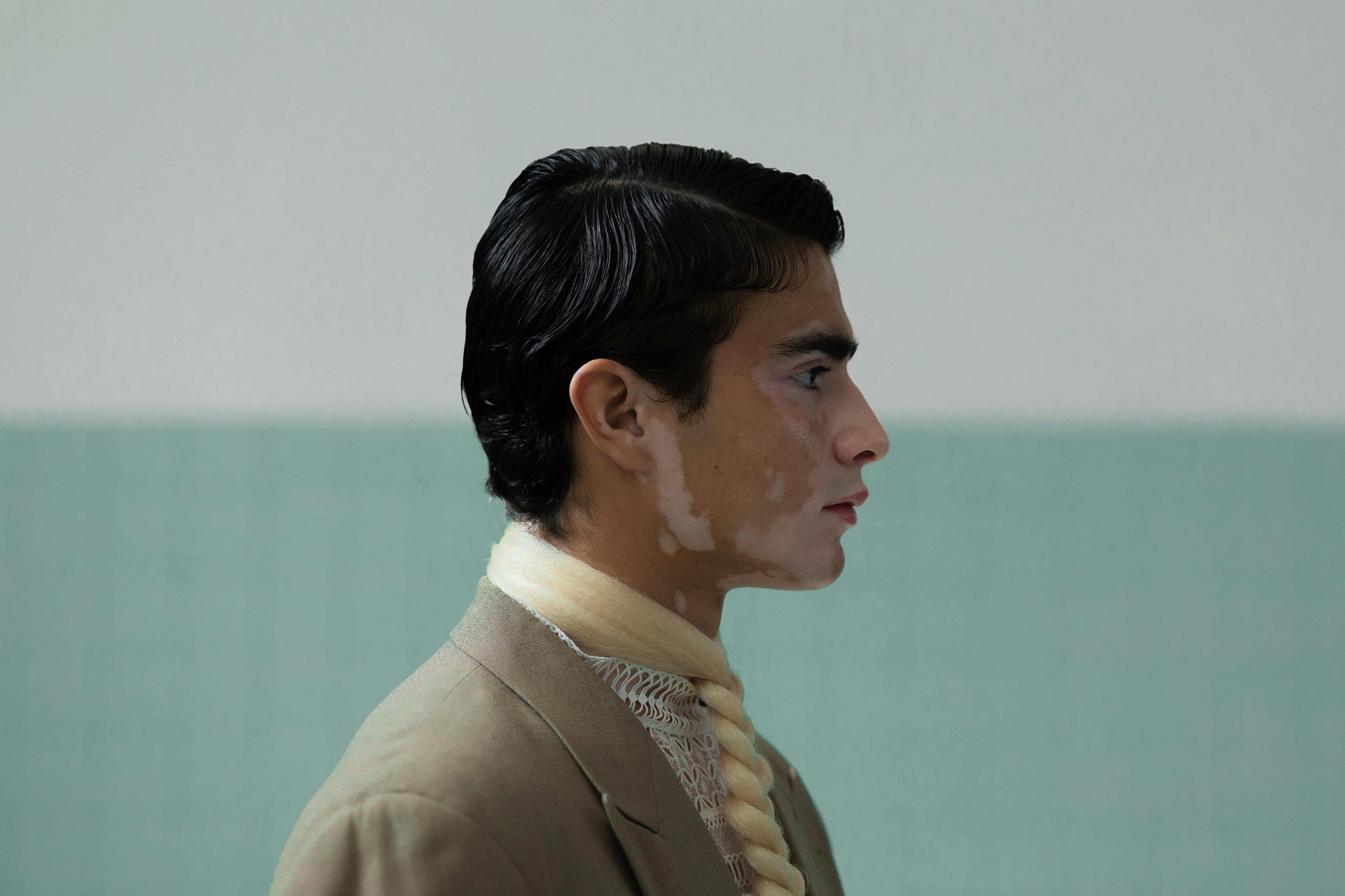 Side profile portrait of a man in a suit, showcasing vitiligo and elegant fashion.