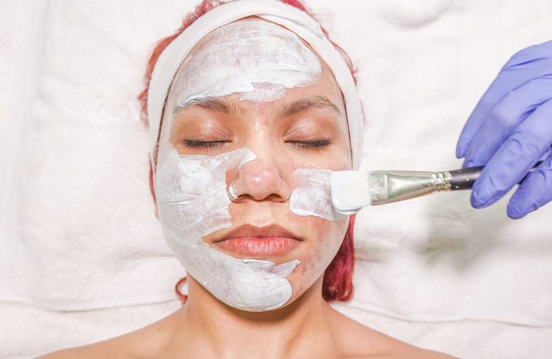 Chemical Peels at Derma Skin and Hair Solutions