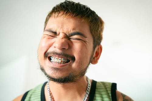 A man with braces on his face is laughing